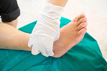 Diabetic Ulcers Treatment in in the Miami, Pembroke Pines, Miami Gardens, Hollywood, Hallandale Beach, Davie, Dania Beach, North Miami, Hialeah, Fort Lauderdale areas